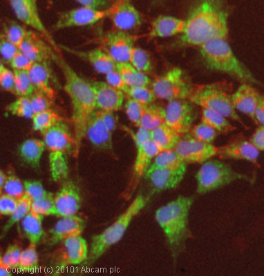 ICC/IF image of ab86863 stained HepG2 cells. The cells were 4% PFA fixed (10 min) and then incubated in 1%BSA / 10% normal goat serum / 0.3M glycine in 0.1% PBS-Tween for 1h to permeabilise the cells and block non-specific protein-protein interactions. The cells were then incubated with the antibody (ab86863, 5µg/ml) overnight at +4°C. The secondary antibody (green) was Alexa Fluor® 488 goat anti-rabbit IgG (H+L) used at a 1/1000 dilution for 1h. Alexa Fluor® 594 WGA was used to label plasma membranes (red) at a 1/200 dilution for 1h. DAPI was used to stain the cell nuclei (blue) at a concentration of 1.43µM. This antibody also gave a positive result in 4% PFA fixed (10 min) HeLa cells at 5µg/ml, and in 100% methanol fixed (5 min) HeLa, HepG2 and MCF7 cells at 5µg/ml