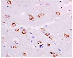 Immunohistochemical analysis of paraffin embedded Human brain tissue labeling RPL7A with ab172478 at 1/50 dilution.