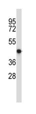Anti-Nuclear Factor Erythroid Derived 2 antibody (ab116057) at 1/100 dilution + MDA-MB435 cell line lysates at 35 µg