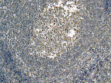 ab167428 showing +ve staining in Human normal tonsil.