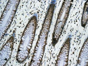 Immunohistochemical analysis of formalin-fixed, paraffin-embedded Human colon tissue, labeling RPS12 using ab167428 at a 1/100 dilution.