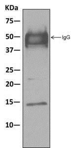 Western blot analysis on immunoprecipitation pellet from Caco-2 cell lysate immunoprecipitated using ab181365 at 1/10 dilution.