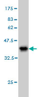 Western blot against tagged recombinant protein immunogen using ab58341 RPS2 antibody at 1ug/ml.
