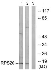 All lanes : Anti-RPS20 antibody (ab74700) at 1/500 dilutionLane 1 : Extracts from HUVEC cells (5-30µg)Lane 2 : Extracts from MCF-7 cells (5-30µg)Lane 3 : Extracts from HUVEC cells (5-30µg), plus immunising peptide (5-10µg)