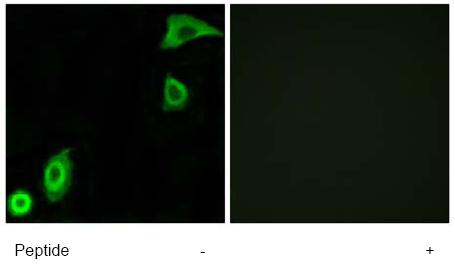 Immunofluorescent staining of A549 cells, using ab74700 at a 1/500 dilution, minus immunising peptide (left image) and plus immunising peptide (right image).