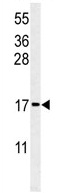 Anti-RPS24 antibody (ab102986) at 1/100 dilution + MCF7 cell line lysate at 35 µg