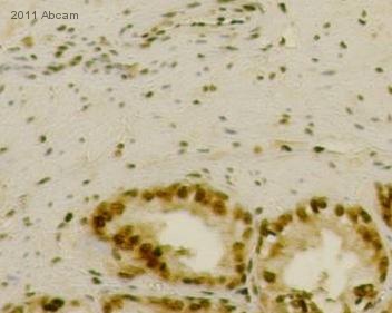 IHC-P image of RPS24 antibody (ab102986) on Seminal Vesicles. The sections were fixed in Paraformaldehyde and underwent heat mediated antigen retrieval using Novacastra (pH6). The sections were then blocked in 0.3% H2O2 solution for 10 minutes at 22°C.See Abreview