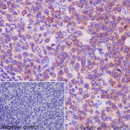 Immunohistochemical analysis of paraffin-embedded Human tonsil tissue labeling RPS24 with ab196652 at 1/100 dilution followed by Goat Anti-Rabbit IgG H&L (HRP) (ab97051) secondary antibody at 1/500 dilution. Cytoplasm staining on Human tonsil tissue is observed. Counter stained with Hematoxylin.