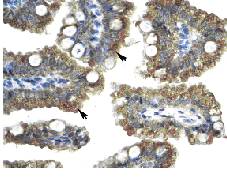 Immunohistochemical analysis of Nicotinic Acetylcholine Receptor alpha expression in paraffin embedded human intestine tissue section using 4 µg/ml ab28489. Arrows indicate positively labelled epithelial cells of intestinal villus.