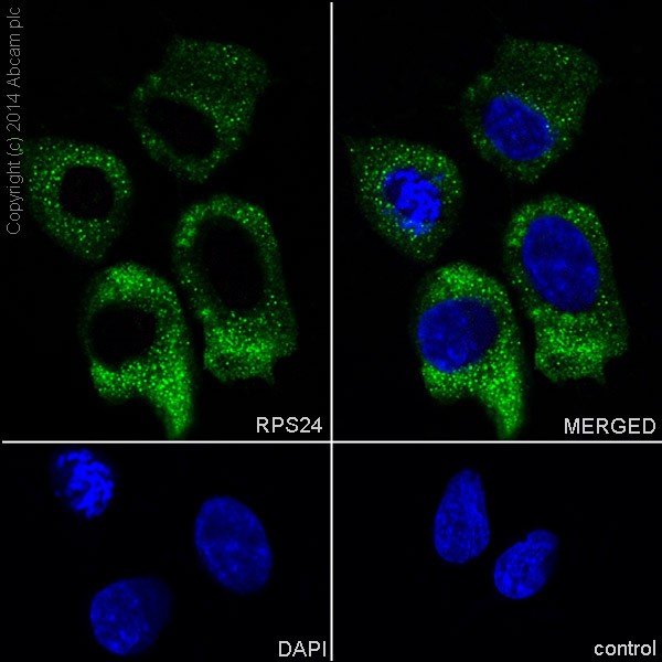 Immunofluorescent analysis of 4% paraformaldehyde-fixed, 0.1% Triton X-100 permeabilized SH-SY5Y (Human neuroblastoma from bone marrow cells) cells labeling RPS24 with ab196652 at 1/250 dilution, followed by AlexaFluor®488 Goat anti-Rabbit (ab150077) secondary antibody at 1/400 dilution (green). Cytoplasm staining on SH-SY5Y cell line is observed. The nuclear counter stain is DAPI (blue).