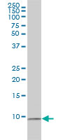 RPS27A antibody (ab57646) at 1ug/lane + HL-60 cell lysate at 25ug/lane.