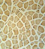 Immunohistochemistry analysis in formalin fixed, paraffin embedded Human skeletal muscle labeling RPS3A with ab174894 at 1/50 dilution, followed by peroxidase conjugation of the secondary antibody and DAB staining.