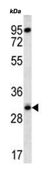 Anti-RPS4Y1 antibody (ab170771) at 1/100 dilution + K562 cell line lysate at 35 µgdeveloped using the ECL technique