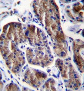 Immunohistochemical analysis of formalin fixed and paraffin embedded Human stomach tissue labeling RPS4Y1 with ab170771 at 1/10 dilution, followed by peroxidase conjugation of the secondary antibody and DAB staining.