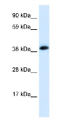 Anti-Nicotinic Acetylcholine Receptor alpha 1 antibody (ab28489) at 0.12 µg/ml + Fetal heart lysateSecondaryHRP conjugated anti-Rabbit IgG HRP conjugated anti-Rabbit IgG (diluted in 1: 50,000 - 100,000)