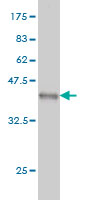 Western blot against tagged recombinant protein immunogen using ab57142 RPS6KC1 antibody at 1ug/ml.
