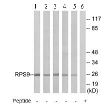 All lanes : Anti-RPS9 antibody (ab74711) at 1/500 dilutionLane 1 : extracts from HepG2 cells at 20 µgLane 2 : extracts from COLO cells at 20 µgLane 3 : extracts from HT-29 cells at 20 µgLane 4 : extracts from HeLa cells at 30 µgLane 5 : extracts from HUVEC cells at 20 µgLane 6 : extracts from HepG2 cells at 20 µg with immunizing peptide at 10 µg
