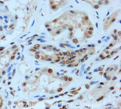 IHC image of RRAGA + RRAGB staining in human normal formalin fixed paraffin embedded tissue section, performed on a Leica BondTM system using the standard protocol F. The section was pre-treated using heat mediated antigen retrieval with sodium citrate buffer (pH6, epitope retrieval solution 1) for 20 mins. The section was then incubated with ab91062, 5µg/ml, for 15 mins at room temperature and detected using an HRP conjugated compact polymer system. DAB was used as the chromogen. The section was then counterstained with haematoxylin and mounted with DPX.