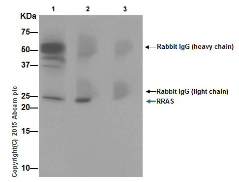 RRAS was immunoprecipitated from Human fetal kidney lysate with ab191791 at 1/60 dilution. Western blot was performed from the immunoprecipitate using ab191399 at 1/500 dilution. Anti-Rabbit IgG (HRP), specific to the non-reduced form of IgG, was used as secondary antibody at 1/1500 dilution.Lane 1: Human fetal kidney lysate 10 µg (Input). Lane 2: ab191791 IP in Human fetal kidney lysate. Lane 3: Rabbit monoclonal IgG (ab172730) instead of ab191791 in Human fetal kidney lysate.Blocking and dilution buffer and concentration: 5% NFDM/TBST.ab191791 was used to Immunoprecipitate RRAS. These precipitates were resolved with ab191399.