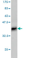 Western blot against tagged recombinant protein immunogen using ab57652 RRM1 antibody at 1ug/ml.