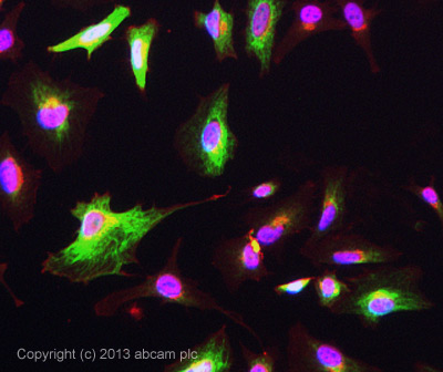 ICC/IF image of ab135383 stained HeLa cells. The cells were 4% formaldehyde fixed (10 min) and then incubated in 1%BSA / 10% normal goat serum / 0.3M glycine in 0.1% PBS-Tween for 1h to permeabilise the cells and block non-specific protein-protein interactions. The cells were then incubated with the antibody ab135383 at 1/100 dilution overnight at +4°C. The secondary antibody (green) was DyLight® 488 goat anti- rabbit (ab96899) IgG (H+L) used at a 1/250 dilution for 1h. Alexa Fluor® 594 WGA was used to label plasma membranes (red) at a 1/200 dilution for 1h. DAPI was used to stain the cell nuclei (blue) at a concentration of 1.43µM.