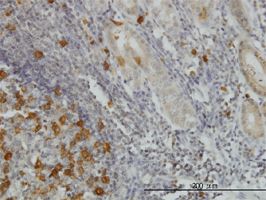 RRM2 antibody (ab57653) used in immunohistochemistry at 5ug/ml on formalin fixed and paraffin embedded human stomach.