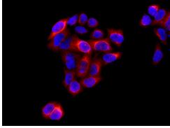 Immunofluorescent analysis of HeLa cells labeling RRM2 with ab172476 at 1/100 dilution (red). DAPI nuclear staining (blue).