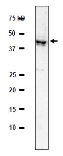 Anti-RRM2 antibody - Azide free (ab191800) at 1/2000 dilution + HeLa whole cell extarct at 20 µg