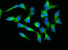 MCF7 cells were fixed with 4% PFA and permeabilized with 0.25% TritonX 100 and stained with ab191800 at a 1/100 dilution. As the secondary antibody, Alexa Fluor® 488 conjugated anti-rabbit IgG antibody was used at 1/1000 dilution. The sample was counter stained with 1.0 μg/mL DAPI in TBS.
