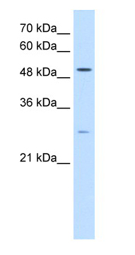 Anti-RRP1 like protein antibody (ab64468) at 0.5 µg/ml + HepG2 cell lysate at 10 µgSecondaryHRP conjugated anti-Rabbit IgG at 1/50000 dilution