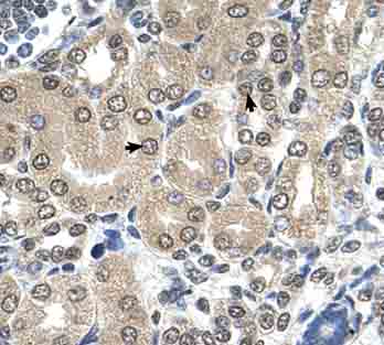 Immunohistochemistry (Formalin/PFA-fixed paraffin-embedded sections) analysis of human kidney tissue labelling RRP1 with ab64468 at 4-8µg/ml. Arrows indicate positively labelled epithelial cells of the renal tubules. Magnification: 400X.