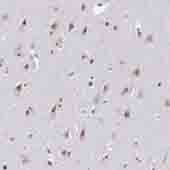 Immunohistochemical staining of Human lateral ventricle with ab121142 1/150 dilution. The staining shows nucleolar positivity in neuronal cells and nuclear positivity in glial cells.