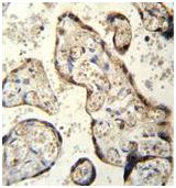 Immunohistochemical analysis of formalin-fixed, paraffin-embedded Human placenta tissue labeling RSBN1 with ab170387 at 1/10 dilution, followed by peroxidase-conjugated secondary antibody and DAB staining.