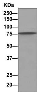 Immunoprecipitation. ab156568 at 1/1000 staining rSec6 in MCF7 lysate immunoprecipitated using ab156568 at 1/10.