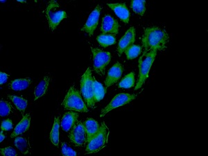 Immunofluorescent analysis of HeLa cells labeling rSec6 with ab156568 at 1/100.