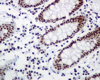 ab109002 at 1/250 dilution, staining RSF1 in Human colon by Immunohistochemistry, Paraffin-embedded tissue.