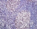ab109002 at 1/250 dilution, staining RSF1 in Human tonsil by Immunohistochemistry, Paraffin-embedded tissue.