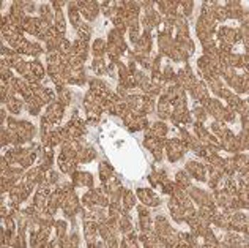 ab121990, at 1/40 dilution, staining RSG1 in Paraffin-embedded Human liver tissue by Immunohistochemistry.