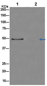 Western blot analysis of Nucleobindin 2 in Human stomach lysate immunoprecipitated with ab181159 at 1/50 dilution (Lane 1). Lane 2: Negative control.Secondary: Anti-Rabbit IgG (HRP), specific to the non-reduced form of IgG at 1/1500 dilution.