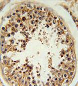 Immunohistochemical analysis of formalin-fixed, paraffin-embedded Human testis tissue labeling RSPO4 with ab175244 at 1/50 dilution, followed by peroxidase conjugation of the secondary antibody and DAB staining.