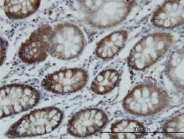 RTKN antibody (ab57655) used in immunohistochemistry at 3ug/ml on formalin fixed and paraffin embedded human colon.