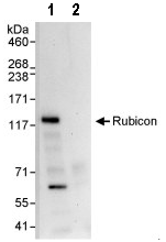 Sample: HeLa whole cell lysate (1 mg for IP, 20% of IP loaded). Antibodies: ab92388 used for WB 1 µg/ml (lane 1) and used for IP at 3 µg/mg lysate. Lane 2: control IgG. Detection: chemiluminescence with exposure time of 30 seconds.