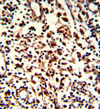 Immunohistochemical analysis of formalin-fixed, paraffin-embedded Human lymph tissue labeling Rubicon with ab173930 at 1/50 dilution, which was peroxidase-conjugated to the secondary antibody, followed by DAB staining.