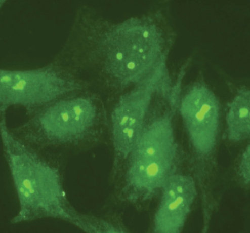 Indirect Immunofluorescence Human HeLa cells were fixed and permeabilized with 4% paraformaldehyde followed by 0.5% Triton X-100. Fixed cells were stained with 10 µg/mL Anti-Nucleolin (ab50279). The antibody was developed with Goat Anti-Rabbit IgG, FITC conjugate.