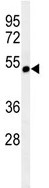 Anti-Nicotinic Acetylcholine Receptor alpha 3 antibody (ab103956) at 1/100 dilution + CEM cell line lysate at 35 µg