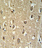 ab103956, at a 1/50 dilution, staining Nicotinic Acetylcholine Receptor alpha 3 in formalin fixed and paraffin embedded Human brain tissue by Immunochemistry. Developed using peroxidase conjugated secondary antibody and DAB staining.
