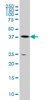 Anti-S adenosylhomocysteine hydrolase antibody (ab54733) at 1/500 dilution + A549 cell lysate at 25 µgSecondaryGoat Anti-Mouse IgG (H&L)-HRP at 1/2500 dilution