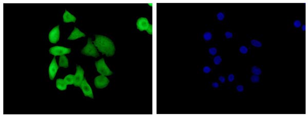 Immunofluorescent analysis of 4% paraformaldehyde-fixed A549 cells labeling S100 alpha 6 with ab181974 at 1/500 dilution, followed by Goat anti rabbit IgG (Dylight 488) at 1/200 dilution (green). Dapi staining (blue).