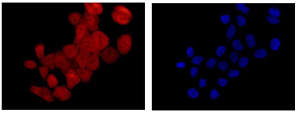 Immunofluorescent analysis of acetone-fixed HeLa cells labeling S100 alpha 6 with ab181974 at 1/500 dilution, followed by Goat anti rabbit IgG (Dylight 555) at 1/200 dilution (red). Dapi staining (blue).
