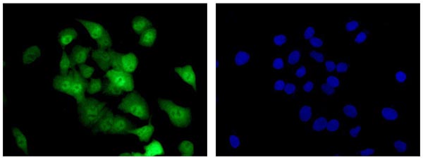 Immunofluorescent analysis of 4% paraformaldehyde-fixed A549 cells labeling S100 alpha 6 with ab181975 at 1/500 dilution, followed by Goat anti rabbit IgG (Dylight 488) at 1/200 dilution (green). Dapi staining (blue).